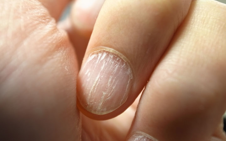 DarkPale fingernails