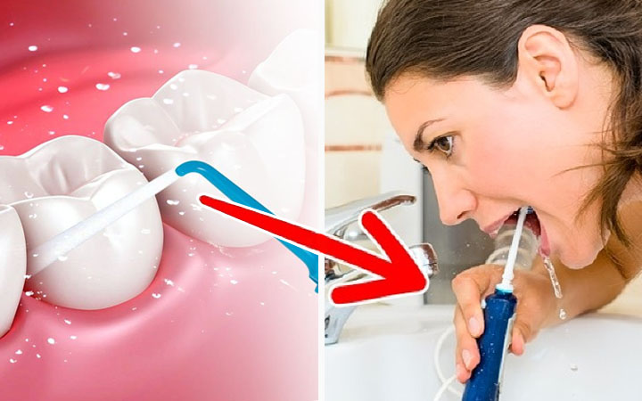 You Don’t Use Additional Tooth-Cleaning Devices