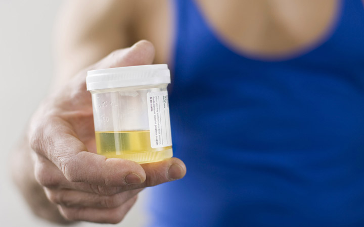 The color of your urine changes